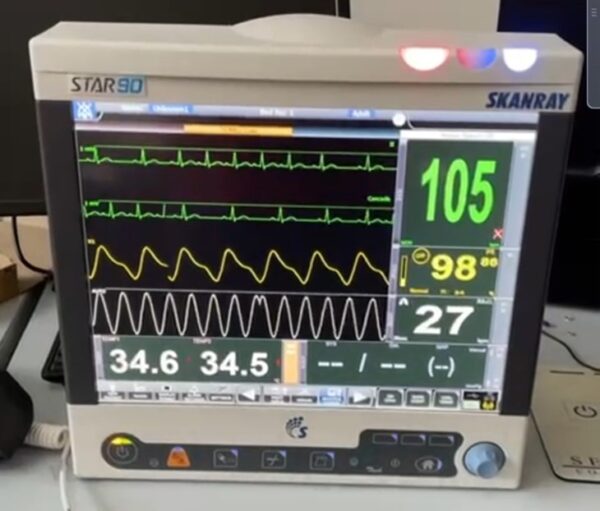 01MONF - MONITOR ECG MULTIFUNZIONE